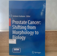 Image of Prostate Cancer