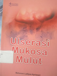 Image of ULSERASI MUKOSA MULUT