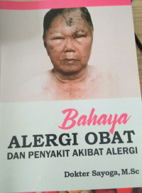 Bahaya ALERGI OBAT